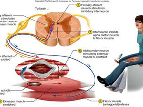 Sciatica: When It's a Nerve Problem vs. a Muscle Problem
