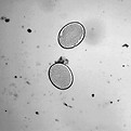 fecal-egg-4.jpg