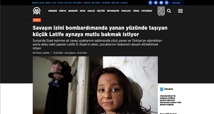 Savaşın izini bombardımanda yanan yüzünde taşıyan küçük Latife aynaya mutlu bakmak istiyor
