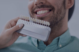 Shade matching for dental repairs
