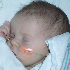 Margot in bed at discharge - 12-4-00 cropped brush.bmp
