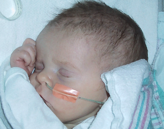 Margot in bed at discharge - 12-4-00 cropped brush.bmp