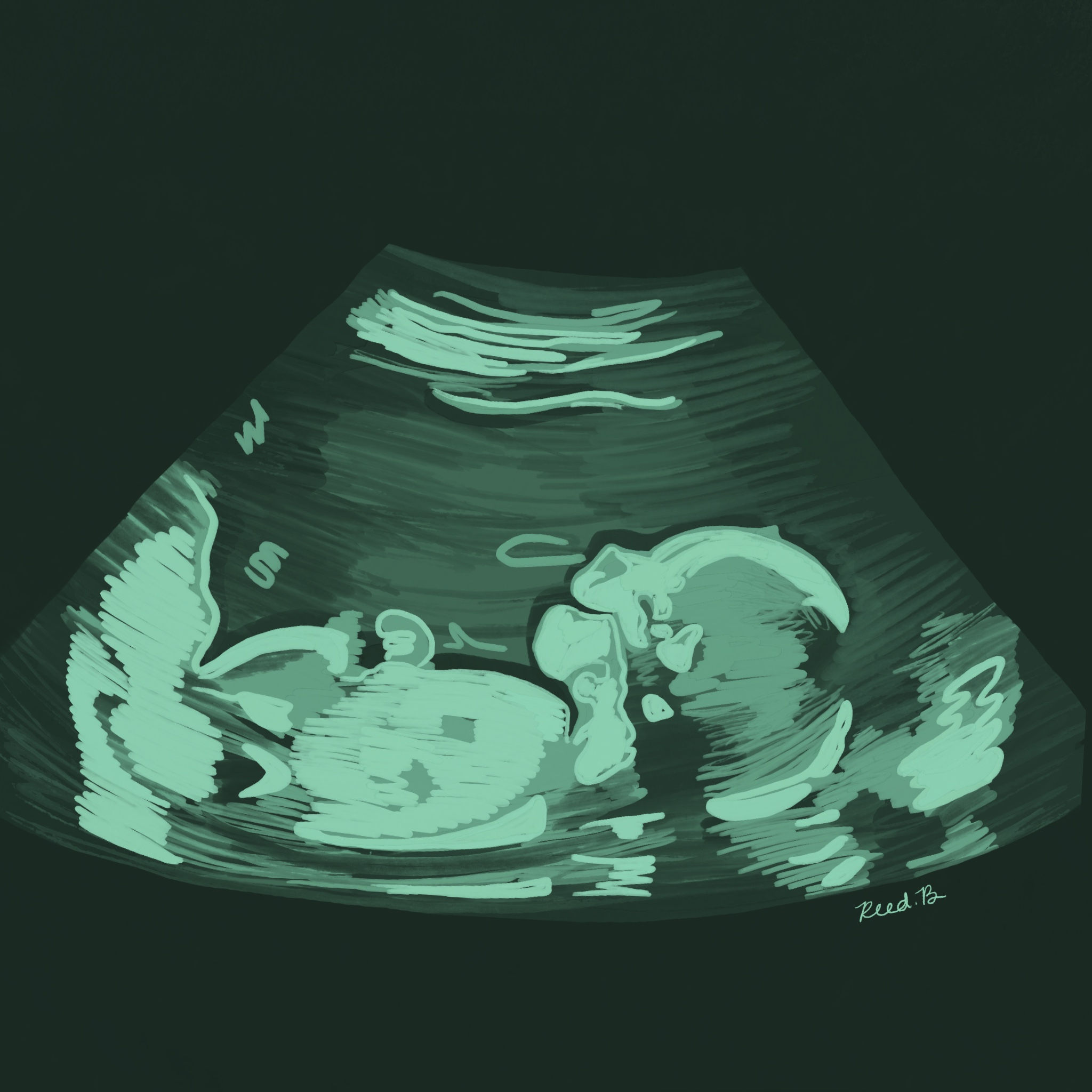 Digital Ultrasound Art