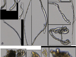 Microplastic pollution on historic facades: Hidden ‘sink' or urban threat? 