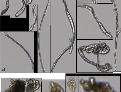 Microplastic pollution on historic facades: Hidden ‘sink' or urban threat? 