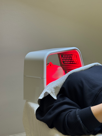 kuorintahoito kasvoille