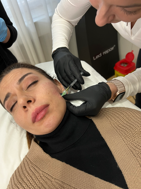 mesoterapia pistoshoito