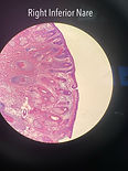 A detailed close-up of the "True Margin" under the microscope