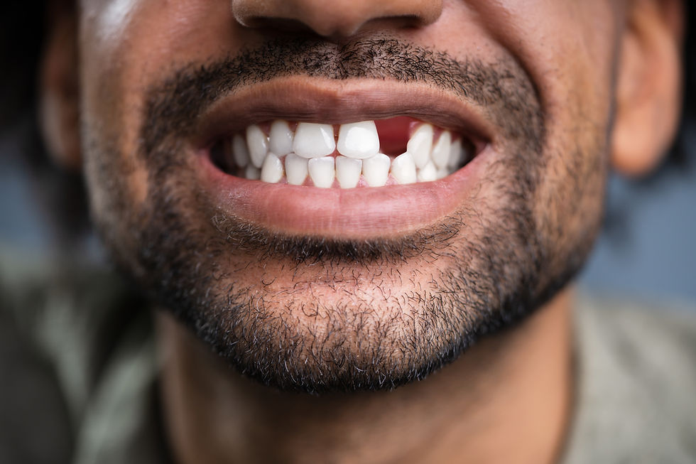 Dr. SmiLee Dental of Killeen, TX 76541, Dentist Office, Dentist near me, Dental Clinic, Dental clinic near me, Killeen Dentist, Harker Heights Dentist, Copperas Cove Dentist, Temple Dentist, Dental Implant, Family Dentist, Cosmetic Dentist, Emergency Dentist, Kid Friendly Dentist, IV Sedation, Invisalign, Braces, Facial esthetics, Botox, Dermal Fillers, PDO Threads, Facelift, Wrinkle Reduction, Trigger Point Therapy, Laser Hair Removal, IPL, Crown, Wisdom Tooth Extractions, Dentures, Dental Checkup Dental Cleaning, Oral Cancer Screening, Bridge, Esthetic Filling, Tooth Bonding, Teeth Whitening, Veneers, Root Canal Therapy