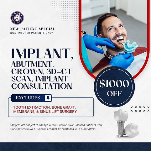 DFW Dental Service in Irving TX 75060 Emergency, Invisalign, Family, Cosmetic, Implants - Dental Implants, Tooth Extraction, Dental Checkup, Cleaning & Examinations, Crowns, Bridges, Implants, Restorations, Veneers, Dentures, Partial Dentures, Emergency Dentist, Invisalign Dentist, Kid Friendly Dentist, Root Canal Therapy