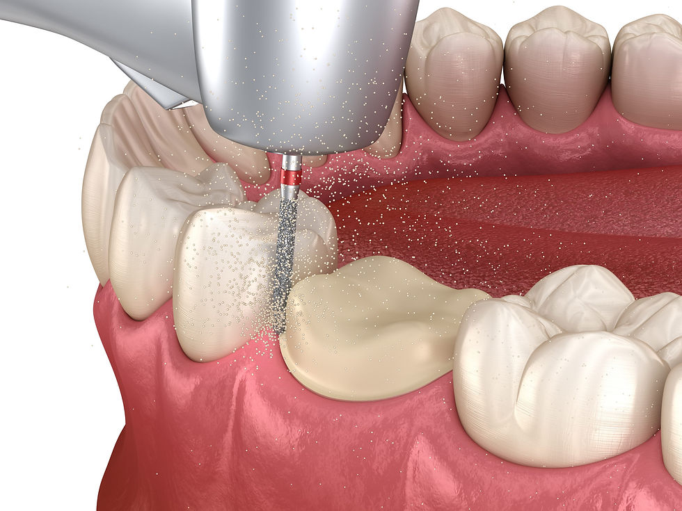 Dental Care of Glen Ellyn, IL 60137 Family, Cosmetic, Implants Dentist - Emergency Dentist, Dental Checkup, Cleaning & Examinations, Crowns, Bridges, Implants, Invisalign, SureSmile, BioClear, Veneers & Laminates, Bonding, Fillings, Dentures, Partial Dentures, Teeth Whitening, Tooth Extractions, Kid Friendly Dentist, Periodontics, Root Canal Therapy, Frenectomy, Sedation, Sleep Apnea Treatment, Inlays & Onlays