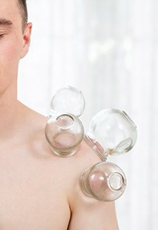 Cupping therapy applied to the shoulder joint to decrease pain and stiffness
