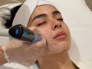 Everything You Need to Know About Exion Face Facial Rejuvenation