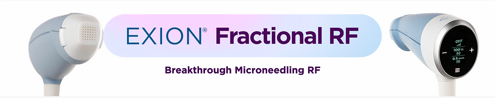 Exion fractional RF