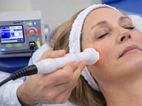 Radiofrequenza medica: quando il rassodamento diventa un trattamento clinico