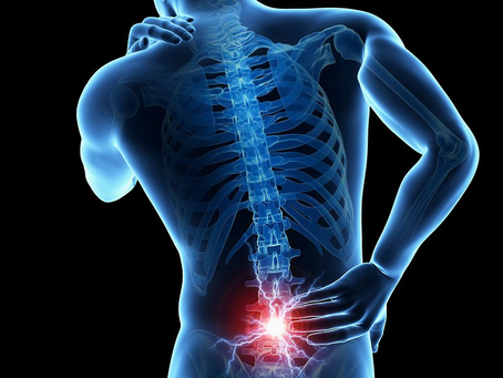 Return to Play en CrossFit: ¿cómo volver a entrenar tras un episodio de dolor lumbar?