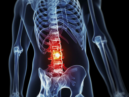 FASE 1: rehabilitación lumbar