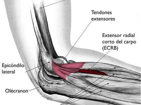 Programa RETURN TO PLAY para Nacho: epicondilitis