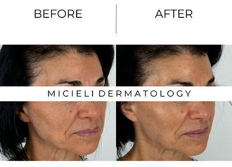 Cosmetic skin treatment – patient receiving aesthetic procedure