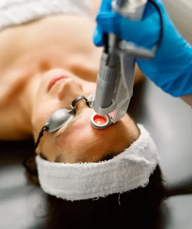 Q10 Fractional Laser