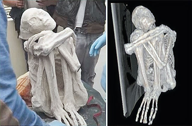 A mummified figure in a fetal position is examined by people wearing gloves. X-ray image shows skeletal details. Pale colors dominate.