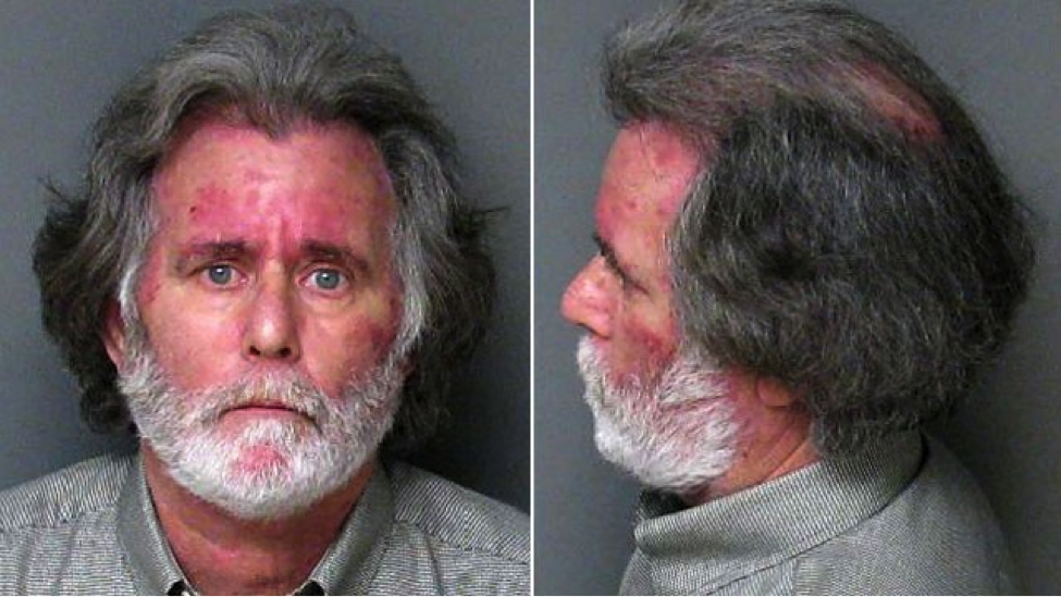 Image Credit: LA Times. James Richard Verone’s booking shots (“mug shots”). His skin has multiple discolored reddish-purple blotches. He is not smiling under his white, short, well-trimmed beard. He is wearing a grey button-down dress shirt. According to articles about Verone, he also had a growth on his chest, two ruptured disks, and some unknown issue with his left foot. He robbed a bank, asking for $1, hoping to see a prison doctor after his arrest.