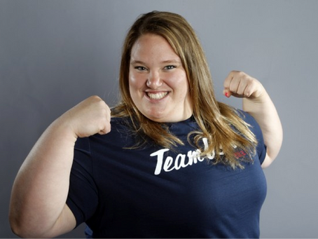 Aiming at Body Size: How Medicalizing Obesity Changes the Very Notion of What it is to be Healthy