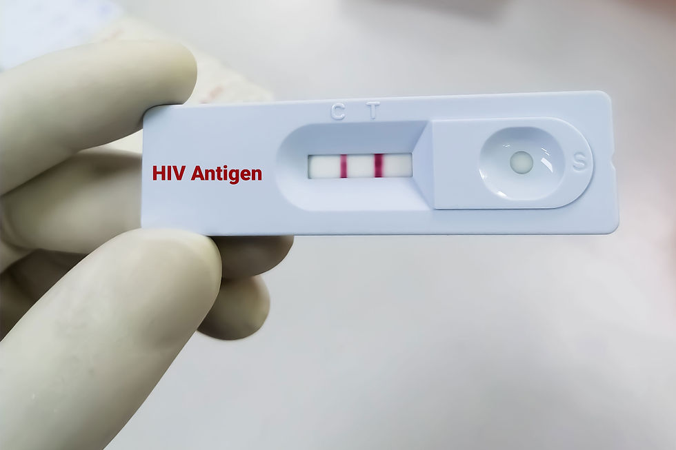 How Accurate Are Fourth-Generation HIV Tests?