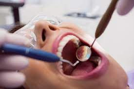 Dental Tooth Filling