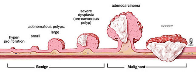 Image courtesy of Johns Hopkins Digestive Disorders Library