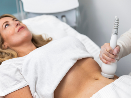 The Importance of Consultation: Customizing Your Laser Fat Reduction Plan