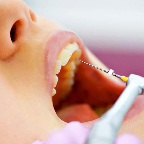 ENDODONCIA