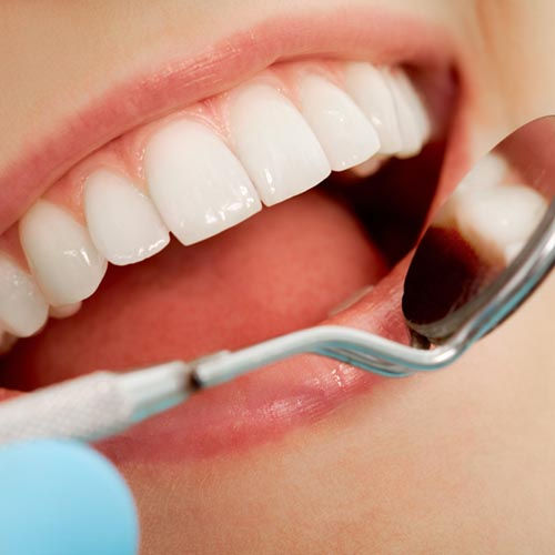 ENDODONCIA