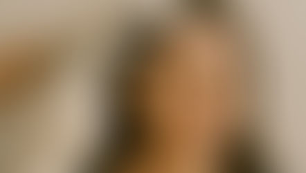 Aplicação de Toxina Botulínica para enxaqueca