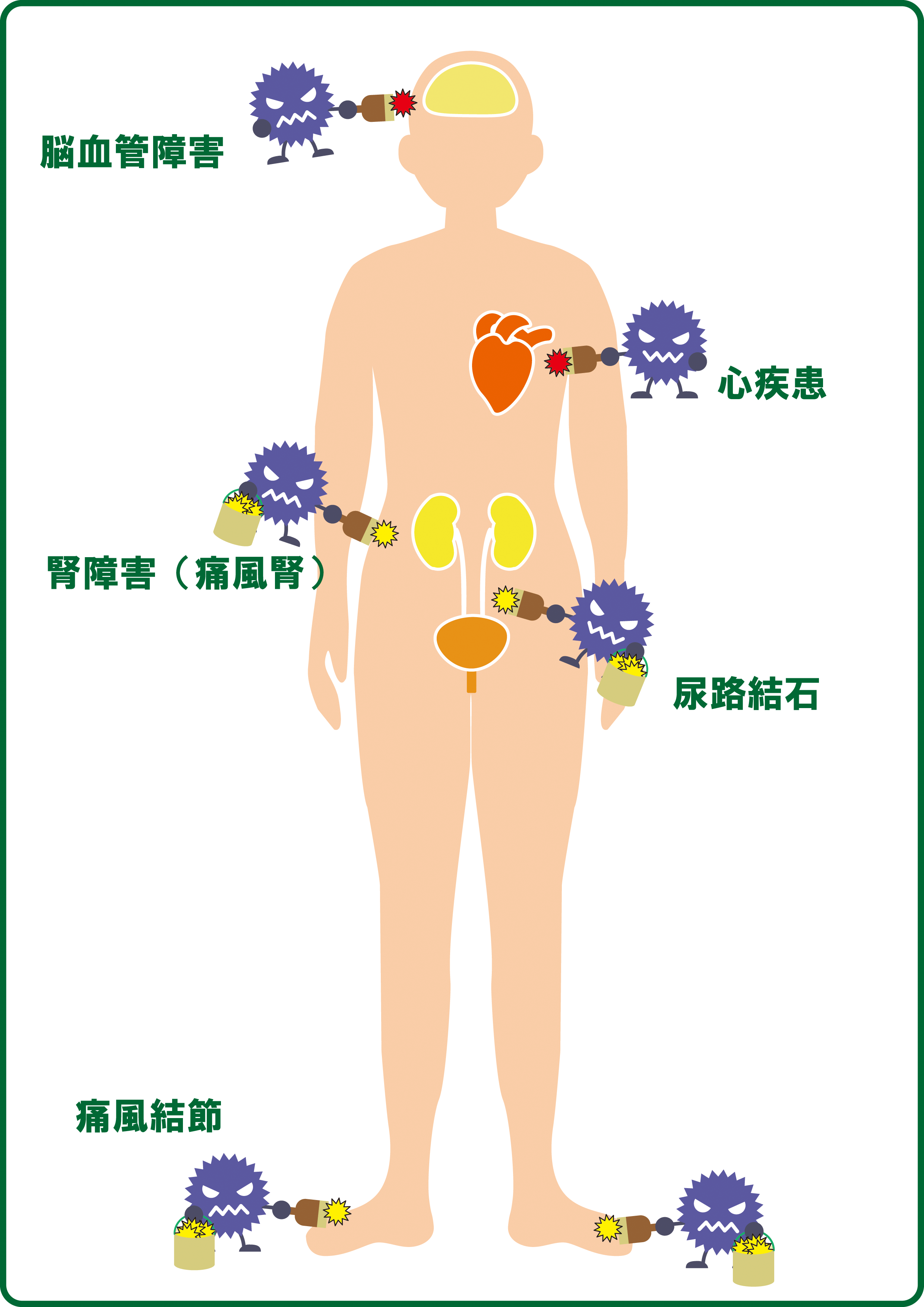 痛風・高尿酸血症③治療について