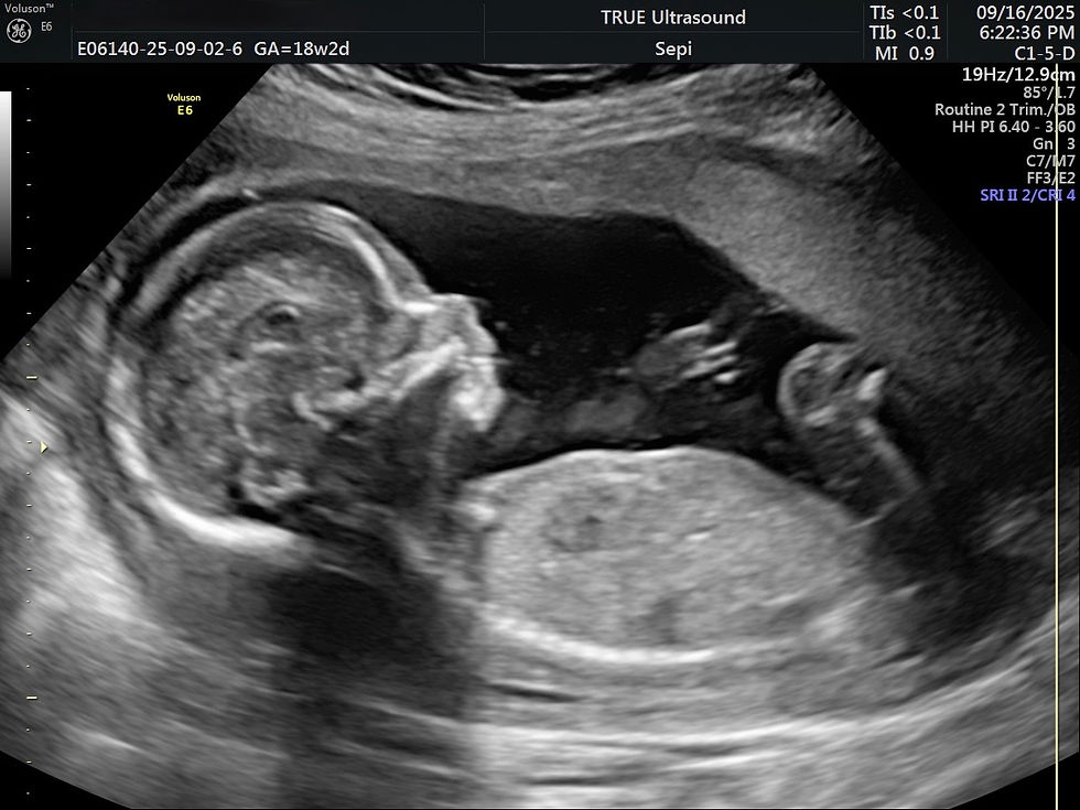 2D ultrasound image of a second trimester baby profile