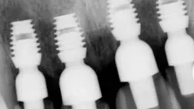 short-bicon-dental-implants-tmb (1).webp