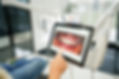 Rovi Smile Center uses the latest advanced technology for accurate TMJ diagnosis and effective treatment in Coral Springs