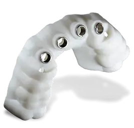 surgical-guide dental implants