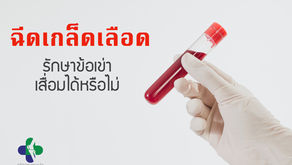 ฉีดเกล็ดเลือดเข้มข้ม   คืออะไร