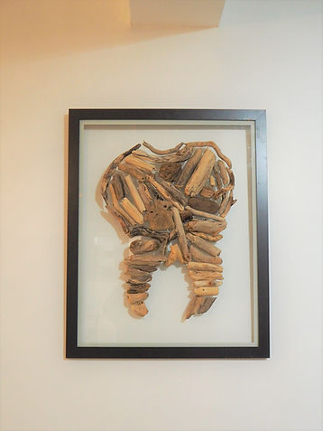 orthodontie lyon ouest appareil dentaire