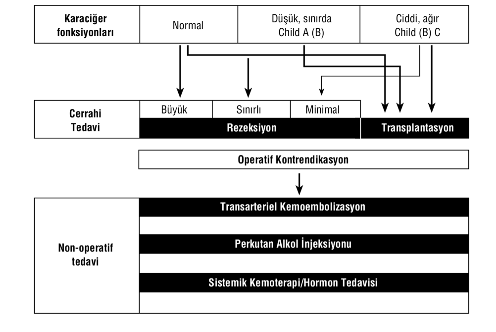 Hepatoselluler Karsinom Tani Ve Tedavisi