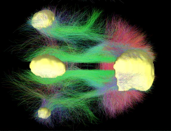 Default_Mode_Network_Connectivity_(cropp