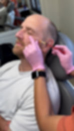 biogel/EZ gel injection