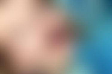 A Systematic Approach to Full-Mouth Reconstruction of the Severely Worn Dentine