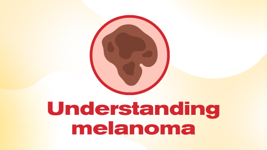 Understanding Melanoma Cancer