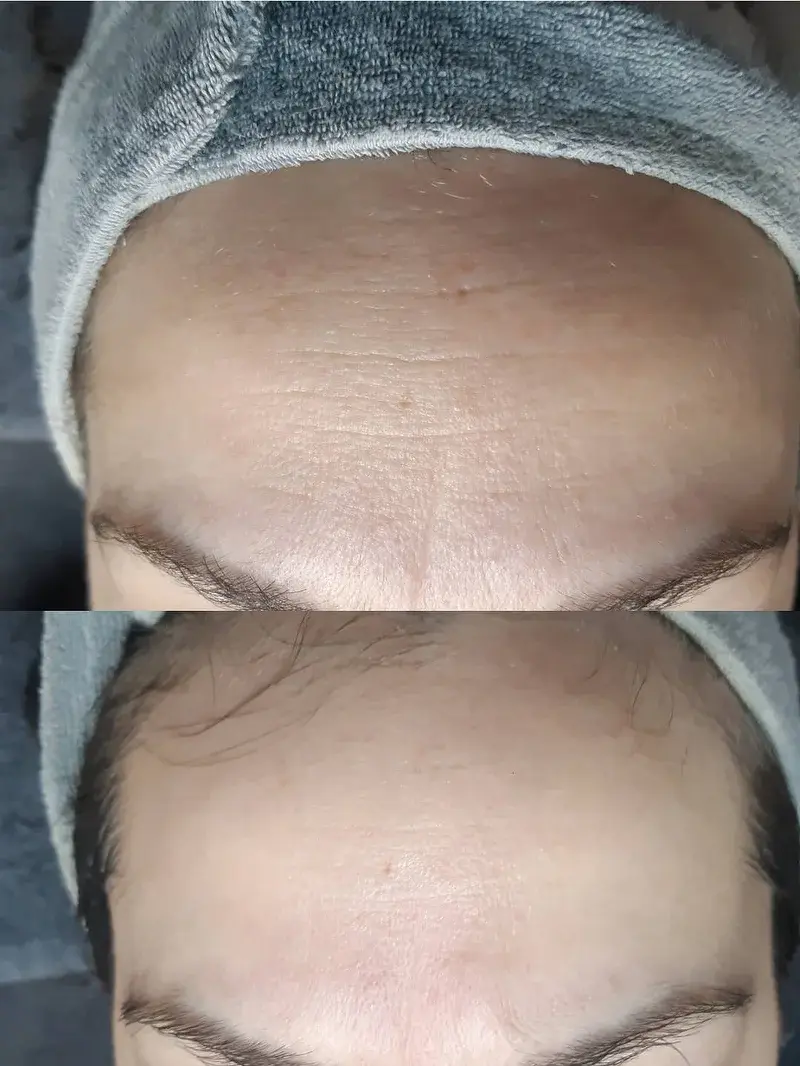 almere, gezichtsbehandeling , deep cleansing, gezichts reining , facial