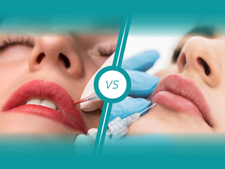 Lip Blush vs. Lip Filler—The Ultimate Showdown