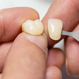 טכנאות שיניים ציוד