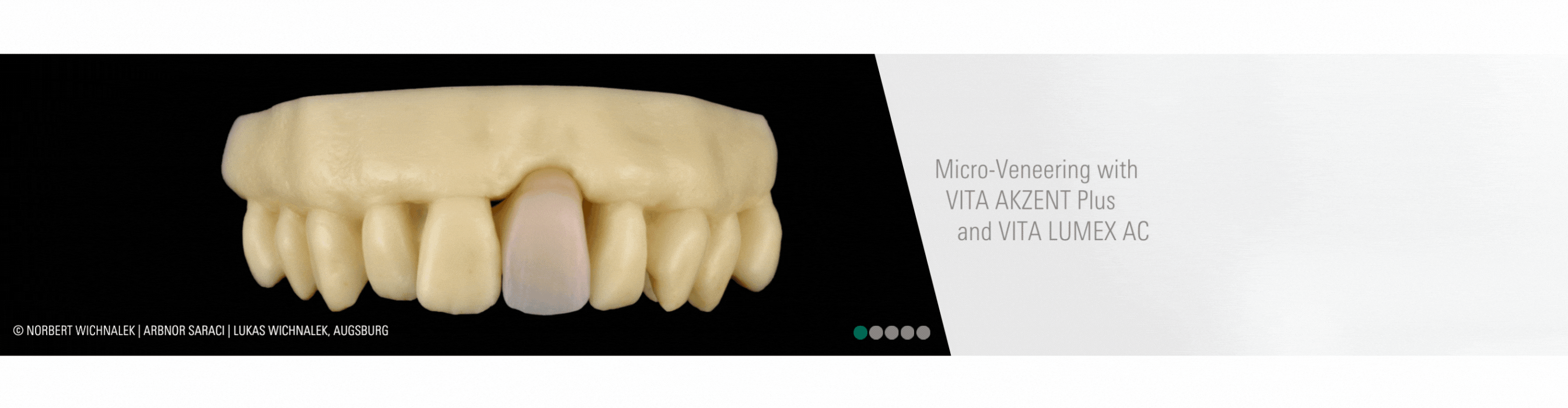 Micro-Veneering_EN_VITA LUMEX AC_Next Generation of Veneering_1920x500.gif